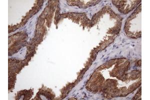 Immunohistochemistry (IHC) image for anti-Amelotin (AMTN) antibody (ABIN2716038) (Amelotin 抗体)