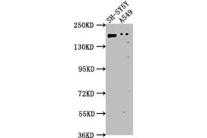 Western Blot Positive WB detected in: SH-SY5Y whole cell lysate, A549 whole cell lysate All lanes: GLI2 antibody at 1:1000 Secondary Goat polyclonal to rabbit IgG at 1/50000 dilution Predicted band size: 168, 134, 132, 89, 87 kDa Observed band size: 168 kDa (GLI2 抗体  (AA 2-20))