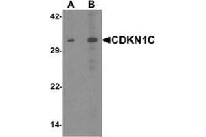 Western blot analysis of CDKN1C in 293 cell lysate with CDKN1C Antibody  at (A) 1 and (B) 2 μg/ml. (CDKN1C 抗体  (N-Term))