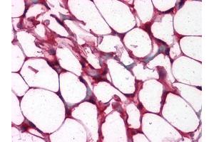 Immunohistochemical analysis of paraffin-embedded human Colon, Adipocytes tissues using anti-ETS1 mouse mAb (ETS1 抗体)