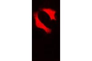 Immunofluorescent analysis of p53 staining in HepG2 cells. (p53 抗体  (C-Term))