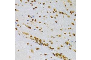 Immunohistochemistry of paraffin-embedded rat brain using HMGB1 Antibody. (HMGB1 抗体  (AA 100-200))