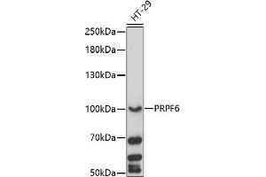 Western blot analysis of extracts of HT-29 cells, using PRPF6 antibody (ABIN7269736) at 1:1000 dilution. (PRP6/ANT-1 抗体  (AA 592-941))