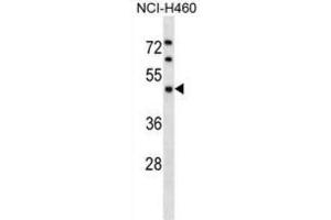 Western Blotting (WB) image for anti-Kaptin (Actin Binding Protein) (KPTN) antibody (ABIN2998936) (KPTN 抗体)