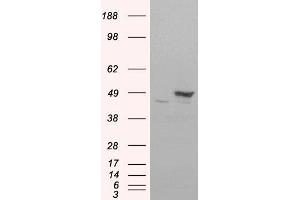 HEK293 overexpressing FLOT1(RC200231) and probed with ABIN184756 (mock transfection in first lane), tested by Origene.