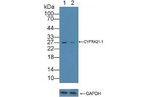 Knockout Varification: Lane 1: Wild-type MCF7 cell lysate, Lane 2: CYFRA21-1 knockout MCF7 cell lysate, Predicted MW: 44kd Observed MW: 50kd Primary Ab: 5 μg/mL Rabbit Anti-Human CYFRA21-1 Antibody Second Ab: 0.