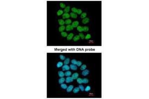 ICC/IF Image Immunofluorescence analysis of paraformaldehyde-fixed A431, using Bloom syndrome protein, antibody at 1:200 dilution. (BLM 抗体  (C-Term))