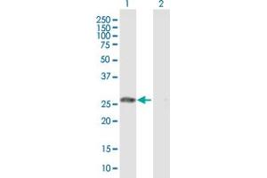 Western Blot analysis of GSTO1 expression in transfected 293T cell line by GSTO1 MaxPab polyclonal antibody. (GSTO1 抗体  (AA 1-241))