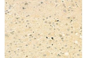 ABIN6263270 and ABIN6268834 at 1/100 staining human normal liver tissue by IHC-P. (DUSP1 抗体  (C-Term))