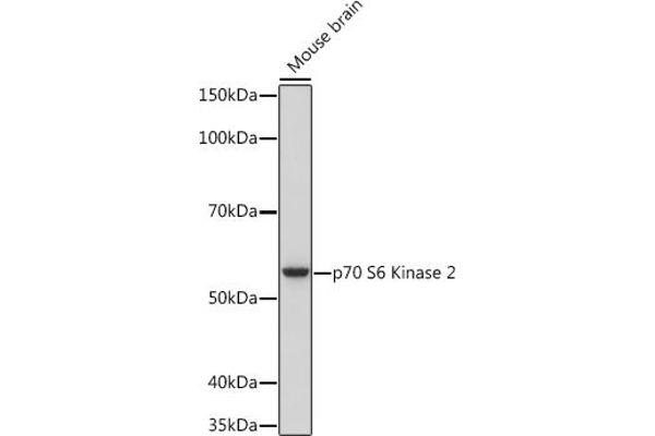 RPS6KB2 anticorps