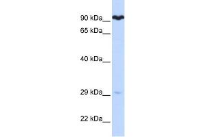 SUPV3L1 antibody used at 1 ug/ml to detect target protein. (SUPV3L1 抗体)