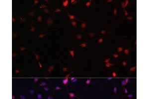 Immunofluorescence analysis of C6 cells using c-Fos Polyclonal Antibody at dilution of 1:100. (c-FOS 抗体)