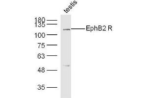 Mouse testis lysates probed with Rabbit Anti-EphB2 R Polyclonal Antibody, Unconjugated  at 1:300 overnight at 4˚C. (EphB2 R (AA 101-200) 抗体)