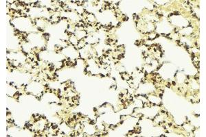 Immunohistochemistry (IHC) image for anti-Neural Precursor Cell Expressed, Developmentally Down-Regulated 9 (NEDD9) (Internal Region) antibody (ABIN6263585)