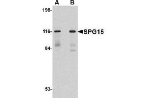 Western Blotting (WB) image for anti-Zinc Finger, FYVE Domain Containing 26 (ZFYVE26) (C-Term) antibody (ABIN1030693) (ZFYVE26 抗体  (C-Term))