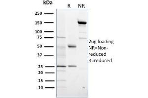 SDS-PAGE (SDS) image for anti-Sulfotransferase Family 1E Member 1 (SULT1E1) antibody (ABIN6940673)