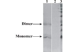 Western-Blot detection of human NRTN expressed in CHO cells. (Neurturin 抗体)
