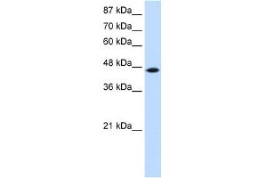 WB Suggested Anti-TRIT1 Antibody Titration:  0. (TRIT1 抗体  (C-Term))