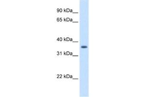 Western Blotting (WB) image for anti-Aldo-Keto Reductase Family 1, Member B10 (Aldose Reductase) (AKR1B10) antibody (ABIN2462603) (AKR1B10 抗体)
