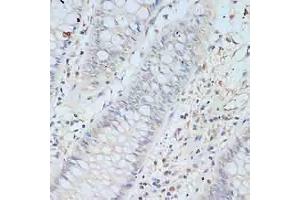Immunohistochemistry of paraffin-embedded human colon using TCEB2 antibody (ABIN6131621, ABIN6148934, ABIN6148936 and ABIN6217328) at dilution of 1:100 (40x lens). (TCEB2 抗体  (AA 1-118))