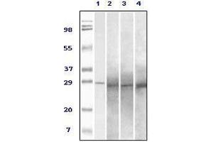 Western blot analysis using Rab25 mouse mAb against truncated Rab25 recombinant protein (1), human overy carcinoma(2), stomach carcinoma (3), breast carcinoma (4) tissue lysate. (RAB25 抗体)