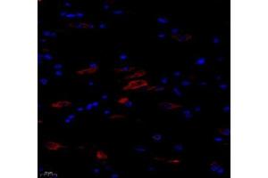 Immunofluorescence of paraffin embedded rat spinal cord using NACAD (ABIN7074756) at dilution of 1:650 (400x lens) (NACAD 抗体)