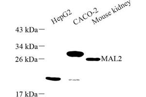 Western blot analysis of MAL2 (ABIN7074549) at dilution of 1: 500 (MAL2 抗体)