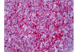 Anti-CR2 / CD21 antibody IHC of human tonsil, germinal center. (CD21 抗体)