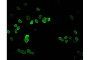 Immunofluorescent analysis of Hela cells using ABIN7139282 at dilution of 1:100 and Alexa Fluor 488-congugated AffiniPure Goat Anti-Rabbit IgG(H+L) (HIST1H3A 抗体  (2meLys9))