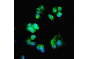 Immunofluorescent analysis of MCF-7 cells using ABIN7175612 at dilution of 1:100 and Alexa Fluor 488-congugated AffiniPure Goat Anti-Rabbit IgG(H+L) (CACNA1H 抗体  (AA 260-360))