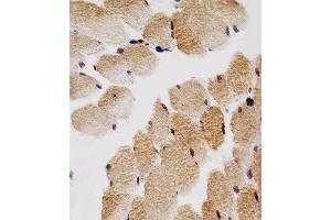 Paraformaldehyde-fixed, paraffin embedded human skeletal muscle tissue, Antigen retrieval by boiling in sodium citrate buffer (pH6. (CDKN1B 抗体)