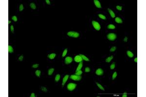 Immunofluorescence of purified MaxPab antibody to RNF25 on HeLa cell. (RNF25 抗体  (AA 1-459))