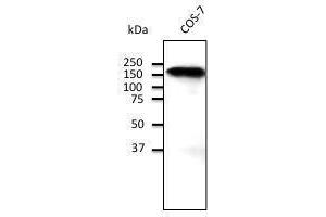 Endogenous CD45 detected With ABOIOO at 1/500 dilution, lysate at 100 µg per Iane and rabbit polyclonal to goat lµg (HRP) at 2/10,000 dilution, (E-cadherin 抗体)