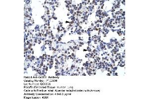 Human Lung (GCM1 抗体  (N-Term))