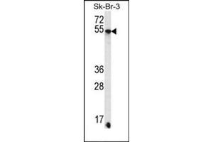 Western blot analysis of SDC3 Antibody (C-term) Cat. (SDC3 抗体  (C-Term))
