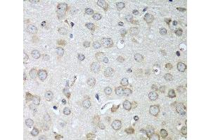 Immunohistochemistry of paraffin-embedded Mouse brain using CDH11 Polyclonal Antibody at dilution of 1:100 (40x lens). (OB Cadherin 抗体)