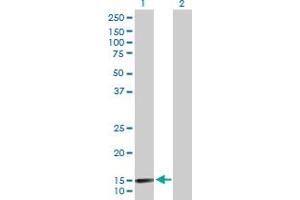 Western Blot analysis of LAMA4 expression in transfected 293T cell line by LAMA4 MaxPab polyclonal antibody. (LAMa4 抗体  (AA 1-120))