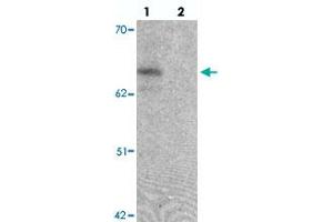 Western blot analysis of ZGPAT in SK-N-SH cell lysate with ZGPAT polyclonal antibody  at 1 ug/mL in (lane 1) the absence and (lane 2) the presence of blocking peptide. (ZGPAT 抗体  (C-Term))