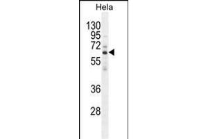 HYAL2 Antibody (C-term) (ABIN654687 and ABIN2844379) western blot analysis in Hela cell line lysates (35 μg/lane). (HYAL2 抗体  (C-Term))