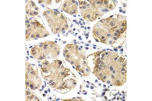 Immunohistochemistry (IHC) image for anti-Chitotriosidase (CHIT1) (AA 217-466) antibody (ABIN3015833) (Chitotriosidase 1 抗体  (AA 217-466))