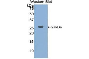 Western Blotting (WB) image for anti-Cathepsin K (CTSK) (AA 115-329) antibody (ABIN1858550) (Cathepsin K 抗体  (AA 115-329))