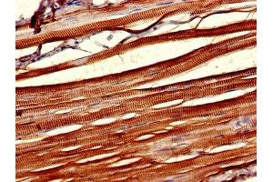 IHC image of ABIN7146858 diluted at 1:1000 and staining in paraffin-embedded human skeletal muscle tissue performed on a Leica BondTM system.