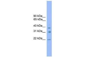 Western Blot showing RNF167 antibody used at a concentration of 1-2 ug/ml to detect its target protein. (RNF167 抗体  (Middle Region))