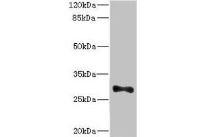 Western blot All lanes: ICAM4 antibody at 4. (ICAM4 抗体  (AA 20-140))