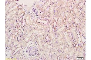 Formalin-fixed and paraffin embedded rat kidney tissue labeled Anti-KGF/FGF7 Polyclonal Antibody, Unconjugated  at 1:300, followed by conjugation to the secondary antibody and DAB staining (FGF7 抗体  (AA 101-194))