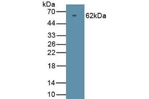Detection of Recombinant PRKG2, Human using Polyclonal Antibody to Protein Kinase, cGMP Dependent Type II (PRKG2) (PRKG2 抗体  (AA 453-728))