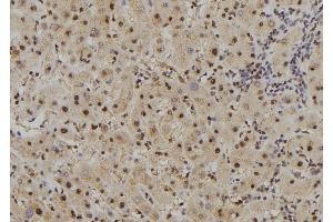 ABIN6261667 and ABIN6277489 at 1/100 staining Human liver tissue by IHC-P. (FAM160B2 抗体  (Internal Region))
