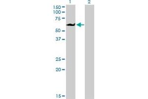 Western Blotting (WB) image for anti-Eukaryotic Translation Initiation Factor 4 gamma 3 (EIF4G3) (AA 1-516) antibody (ABIN599055) (EIF4G3 抗体  (AA 1-516))