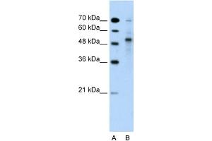 WB Suggested Anti-TRIM59 Antibody Titration:  5. (TRIM59 抗体  (Middle Region))