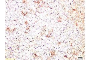 Immunohistochemistry (Paraffin-embedded Sections) (IHC (p)) image for anti-Connective Tissue Growth Factor (CTGF) (AA 221-349) antibody (ABIN672636)